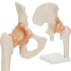 4FIZJO Model anatomiczny stawu biodrowego z więzadłami w skali 1:1 Online