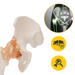 4FIZJO Model anatomiczny stawu biodrowego z więzadłami w skali 1:1 Online